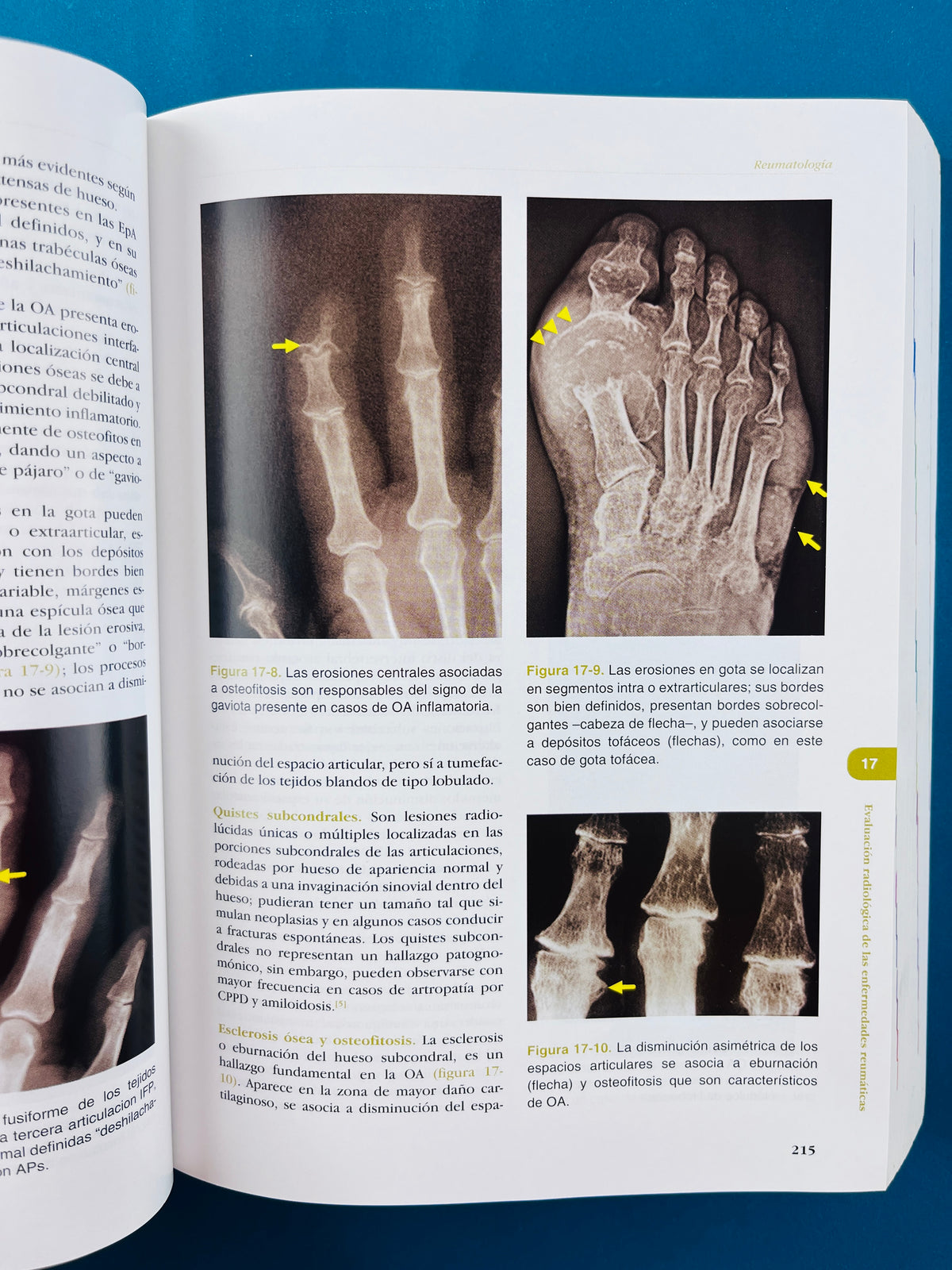 Fundamentos de medicina Reumatología séptima edición by Hernán Vélez William Rojas Jaime Borrero Jorge Restrepo