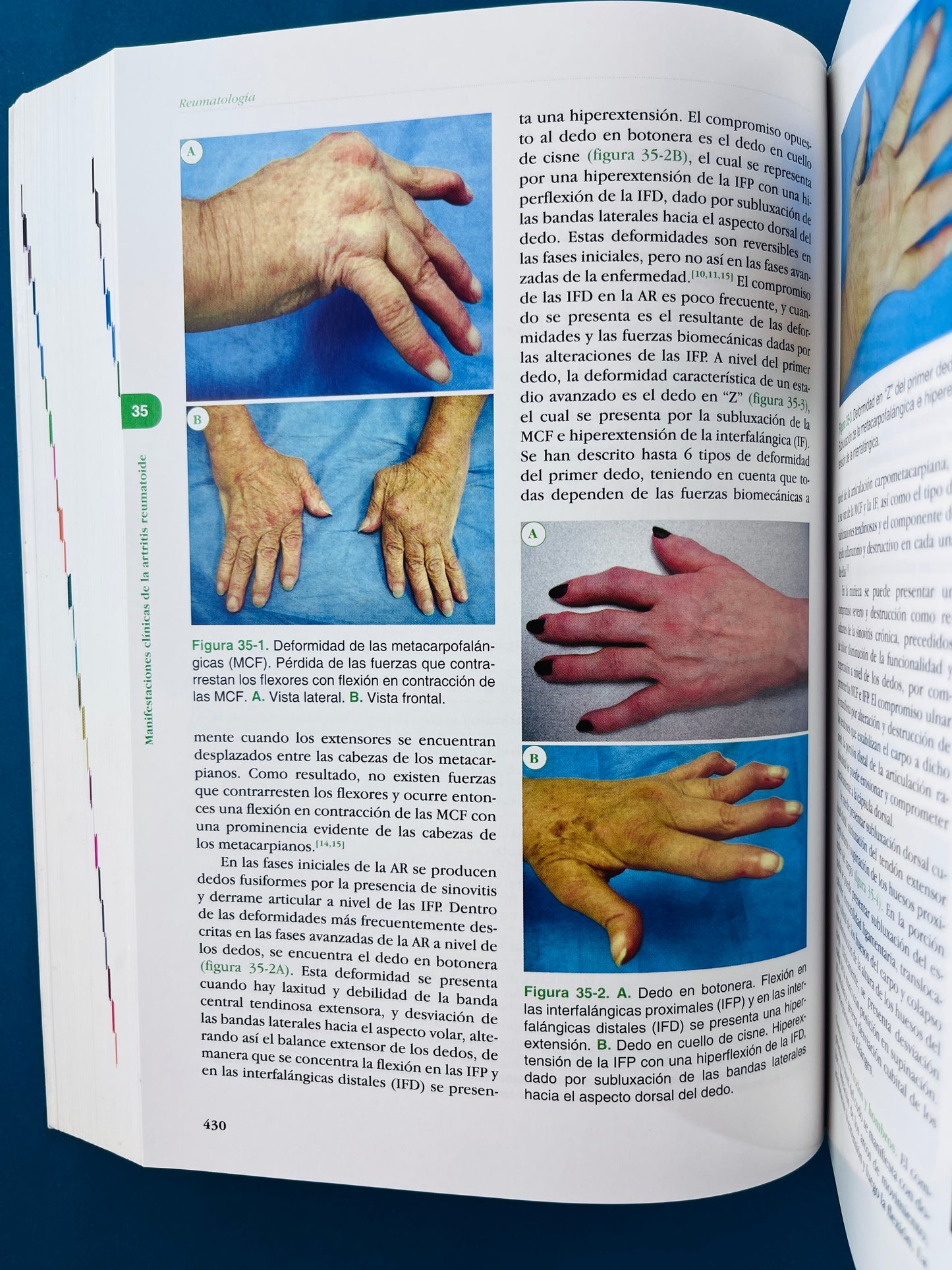 Fundamentos de medicina Reumatología séptima edición