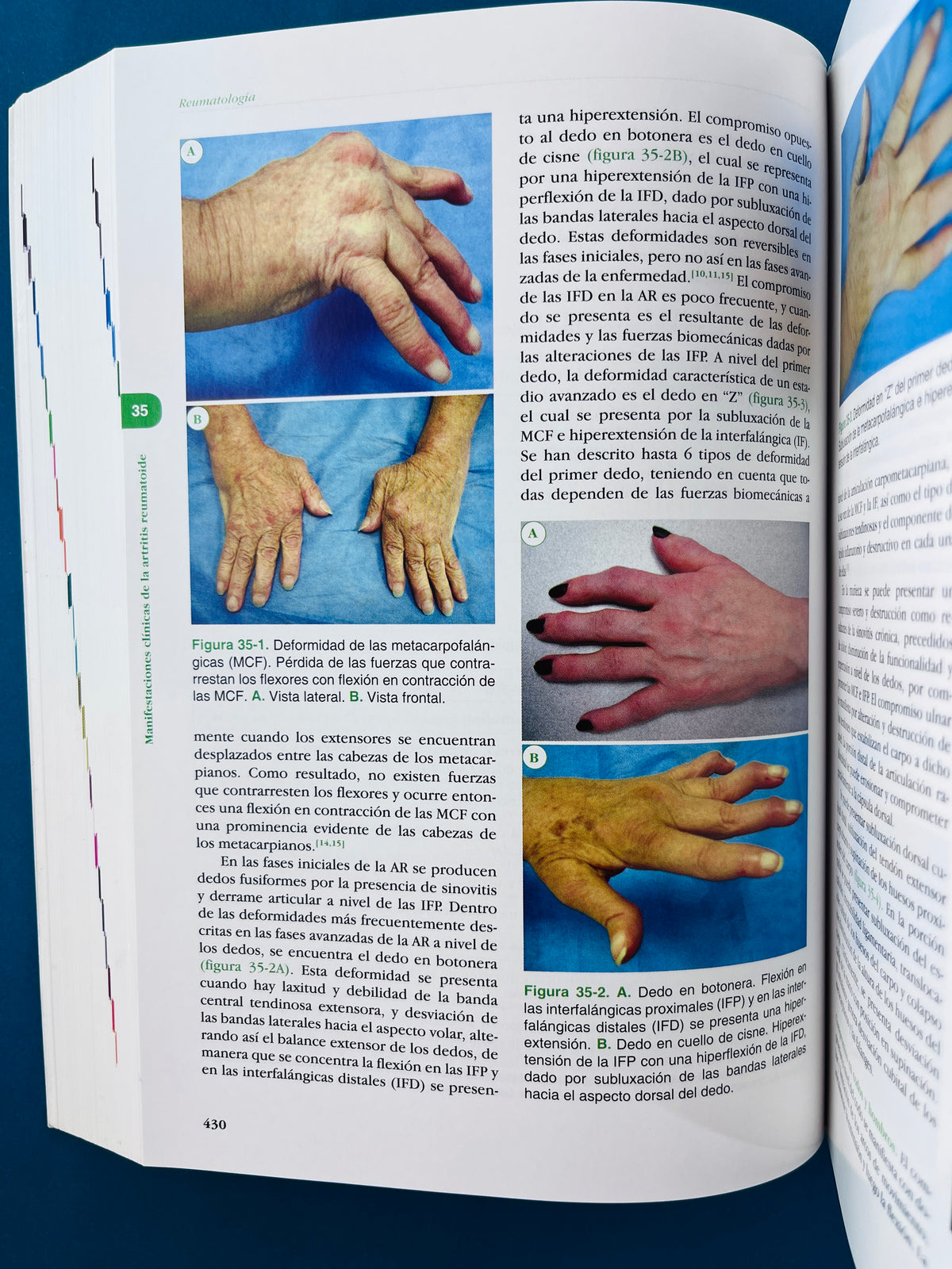 Fundamentos de medicina Reumatología séptima edición by Hernán Vélez William Rojas Jaime Borrero Jorge Restrepo