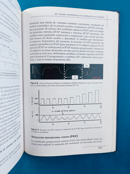 Ventilación mecánica no invasiva