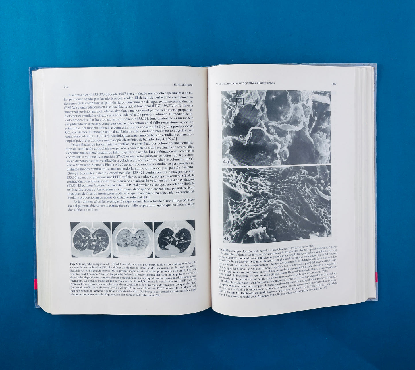 Ventilación mecánica tercera edición