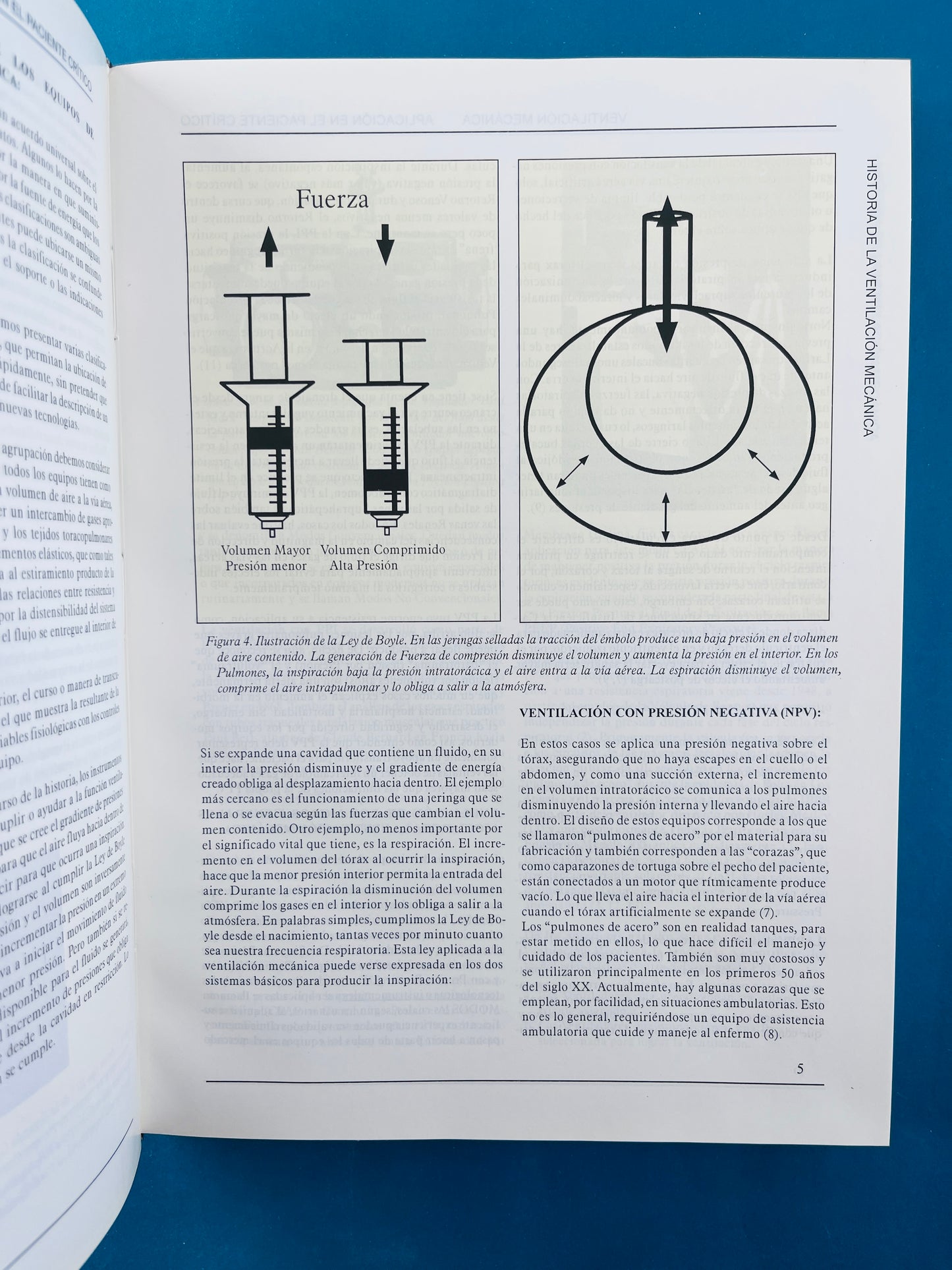 Ventilación mecánica Aplicación en el paciente crítico