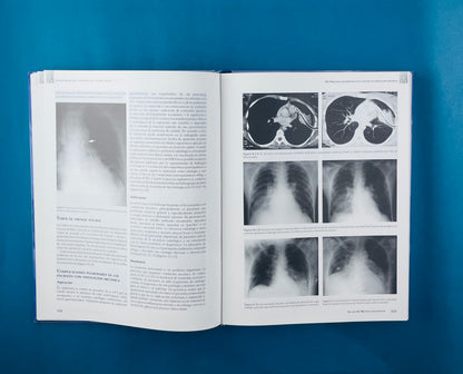 Ventilación mecánica aplicación en el paciente critico segunda edición