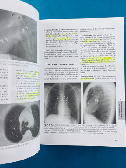 Fundamentos de medicina Neumologia sexta edición