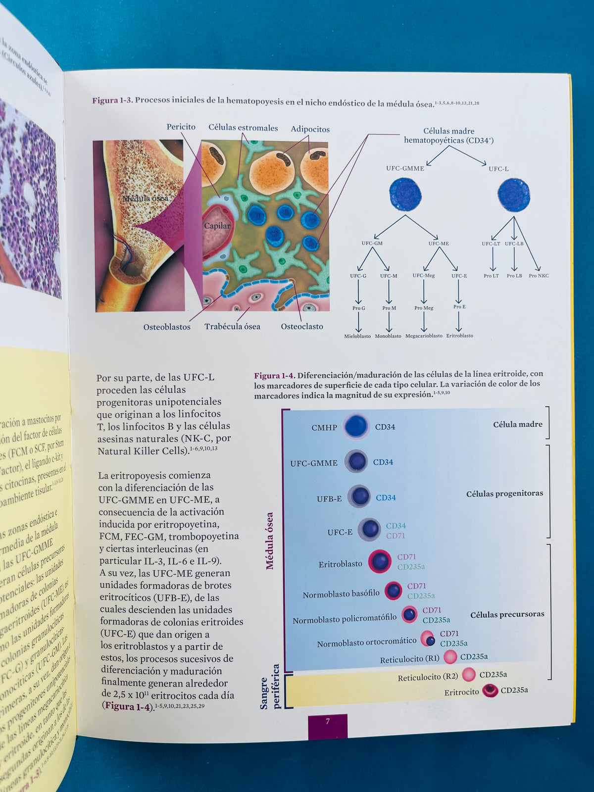 Atlas de enfermedades hematológicas by Varios