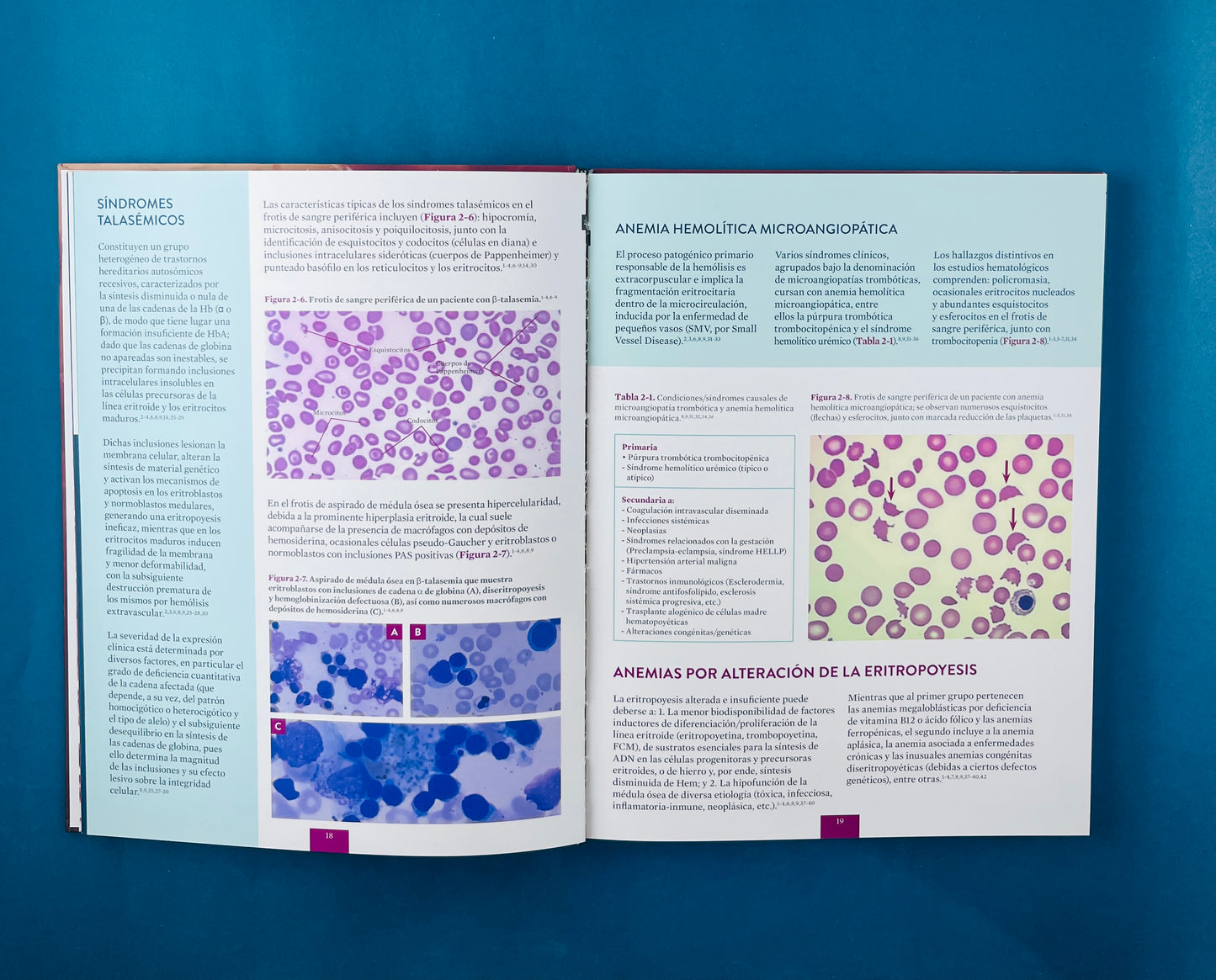 Atlas de enfermedades hematológicas