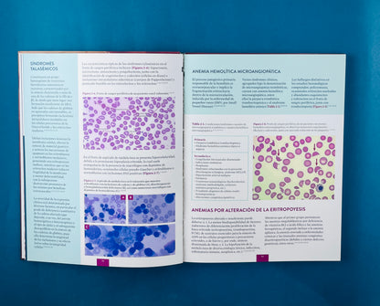 Atlas de enfermedades hematológicas