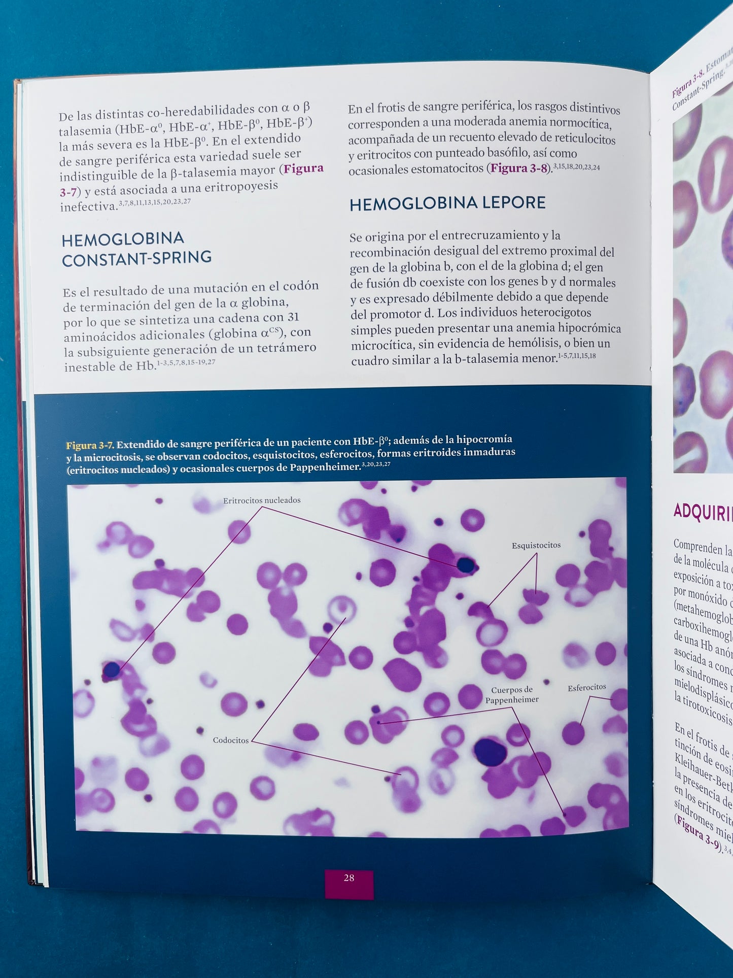 Atlas de enfermedades hematológicas