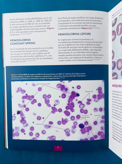 Atlas de enfermedades hematológicas