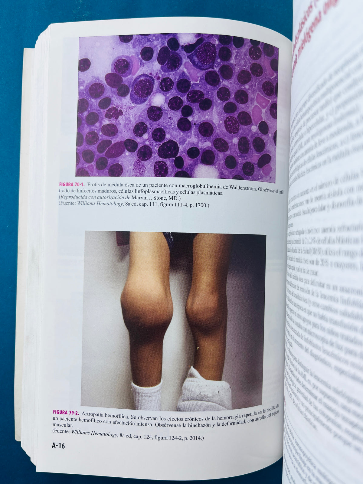 Williams manual de hematología octava edición by Marshall A Lichtman Kennet Kaushansky Thomas J Kipps Josef T Prchal Marcel M Levi