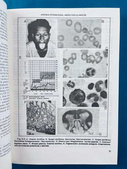 Fundamentos de medicina Hematología segunda edición