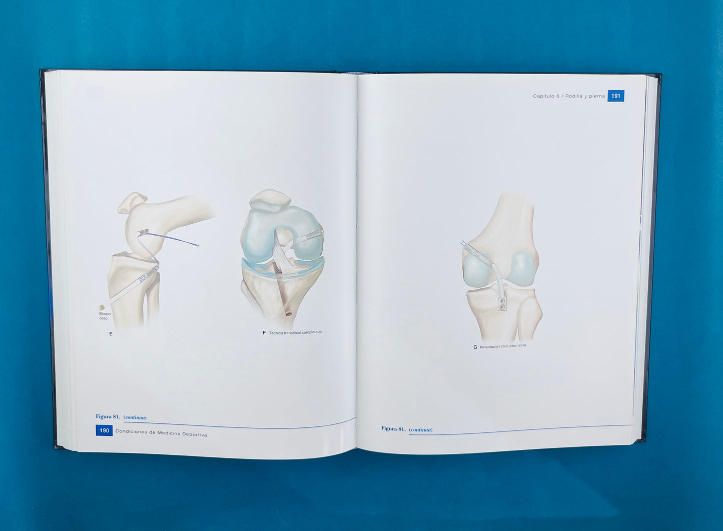 Condiciones de medicina deportiva reconocimiento, tratamiento planificación