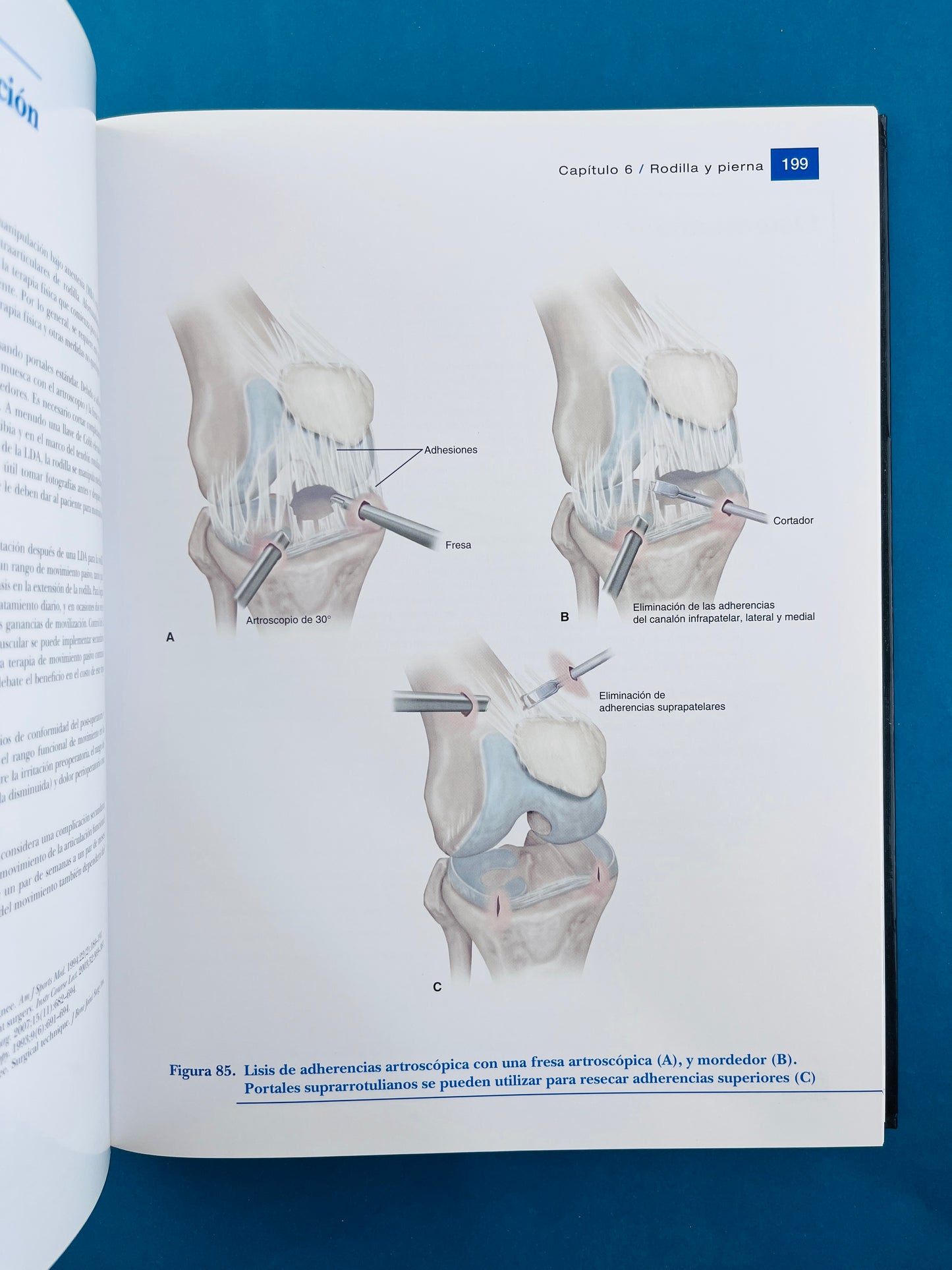 Condiciones de medicina deportiva reconocimiento, tratamiento planificación