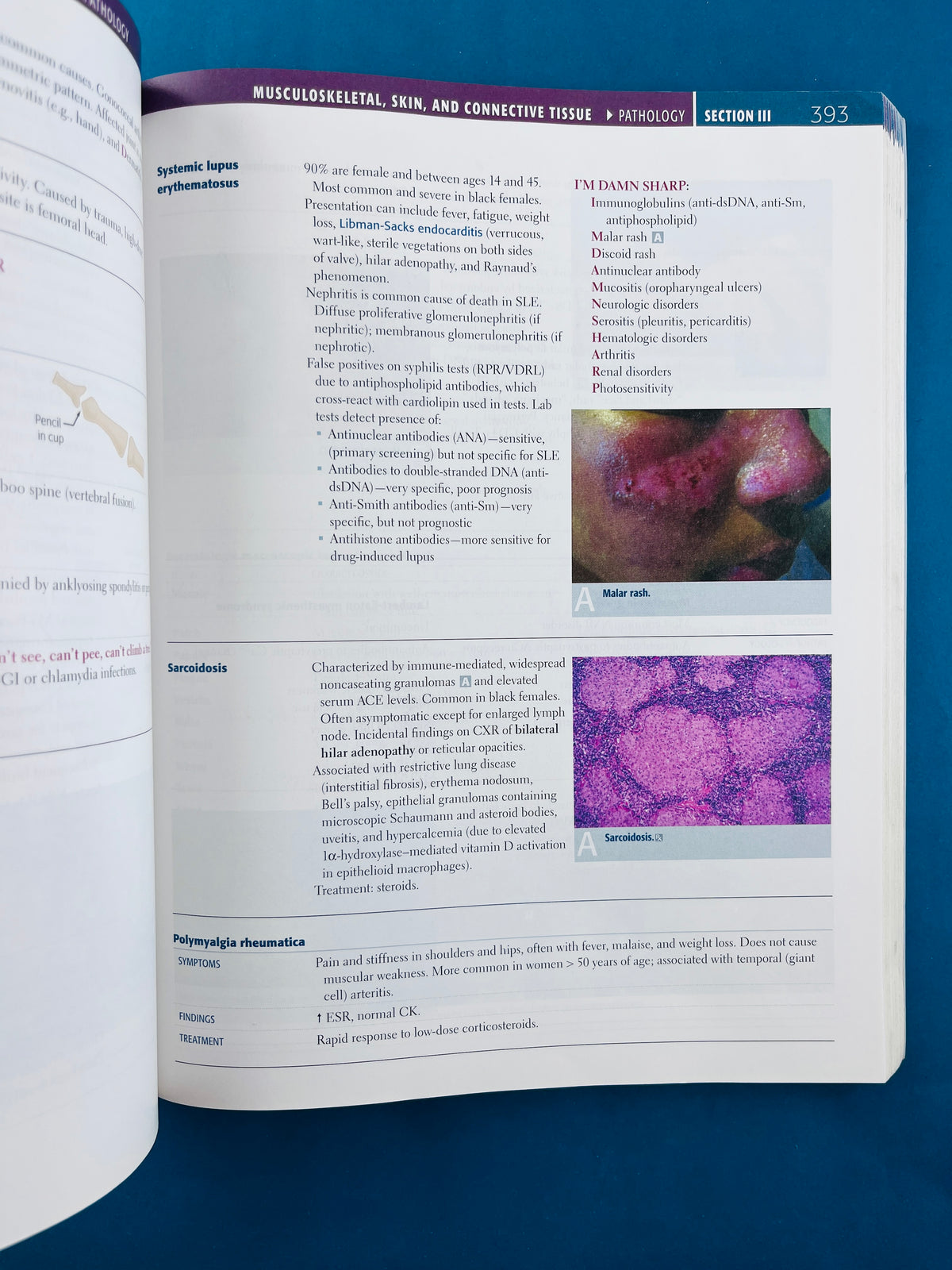 First aid for the usmle step 1 2013 by Tao Le Vikas Bhushan Matthew Sochat