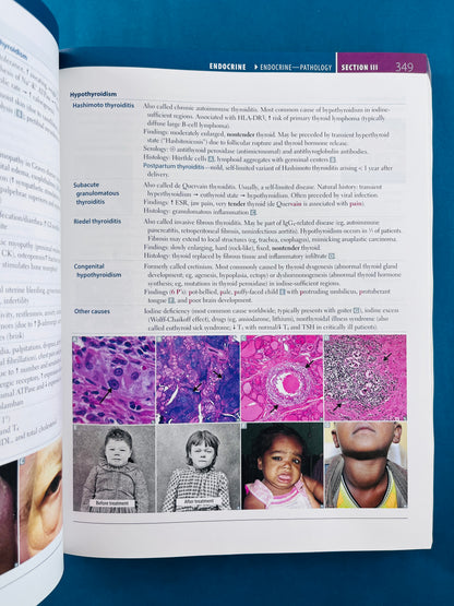 First aid for the usmle step 1 2021