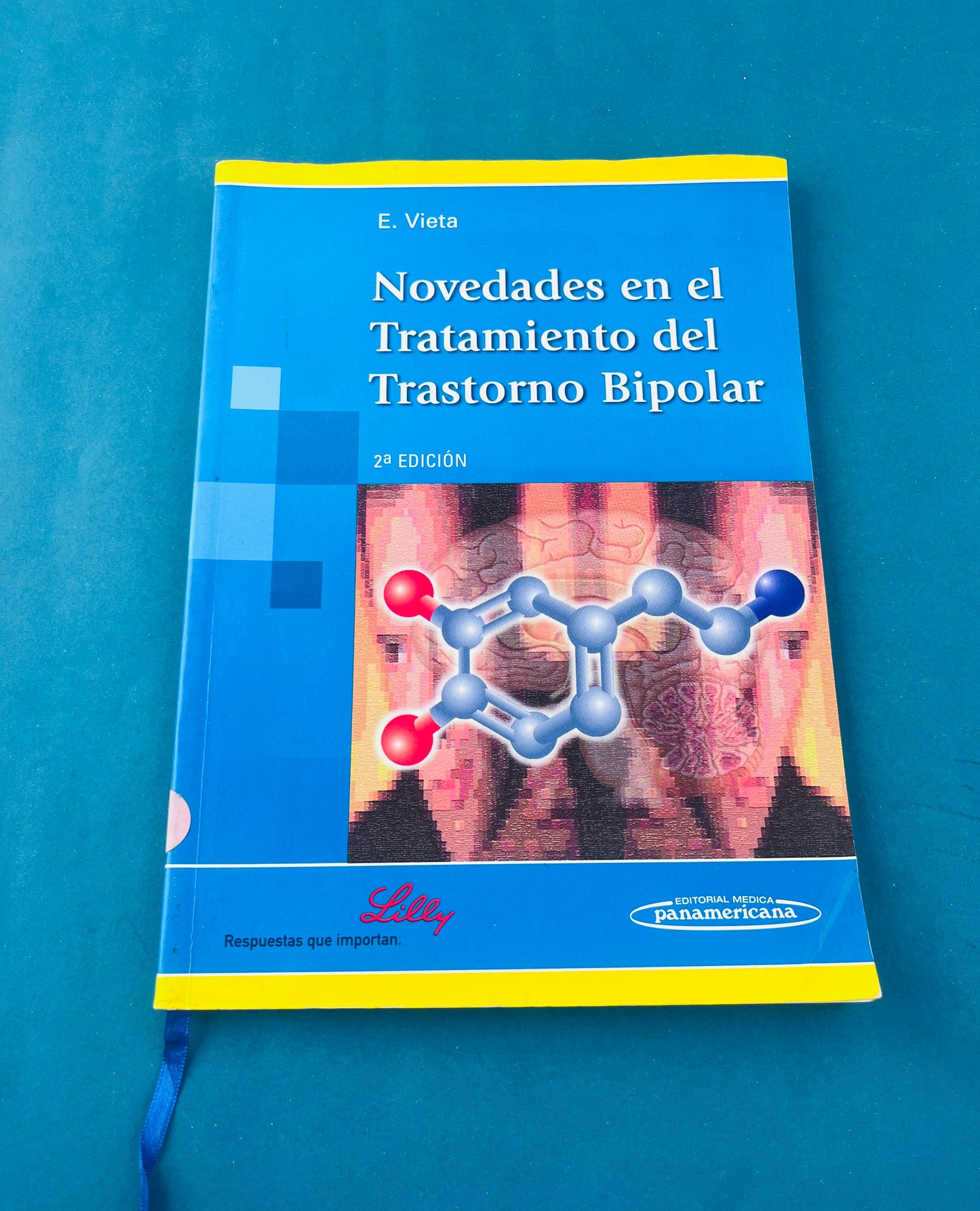 Novedades en el tratamiento del trastorno bipolar