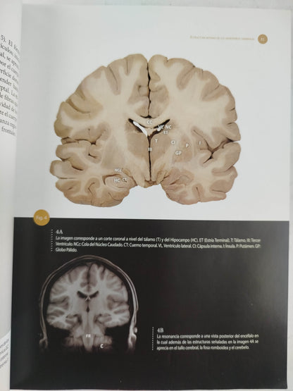 Sistema nervioso Neuroanatomía funcional y clínica by martha i escobar