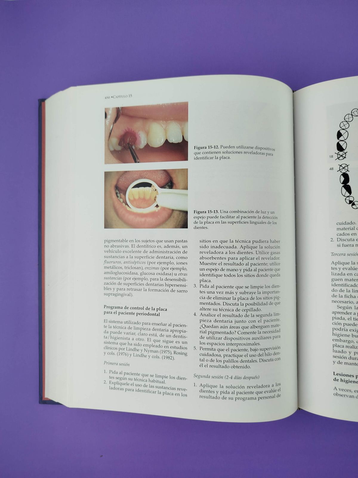 Periodontología clínica e implantología odontológica tercera edición by Jan Lindhe