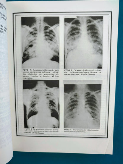 Fundamentos de medicina Enfermedades infecciosas segunda edición
