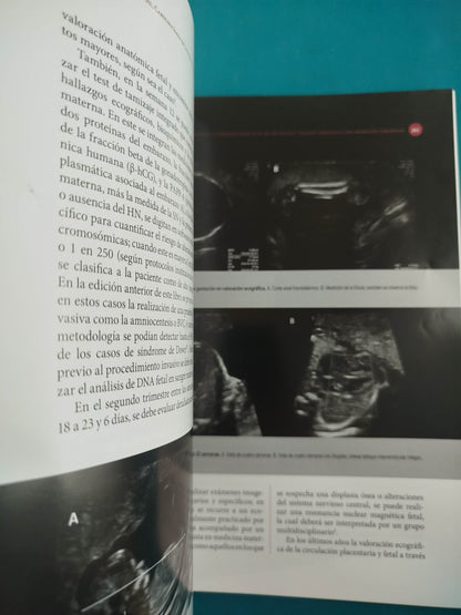 Embriología humana integrada segunda edición