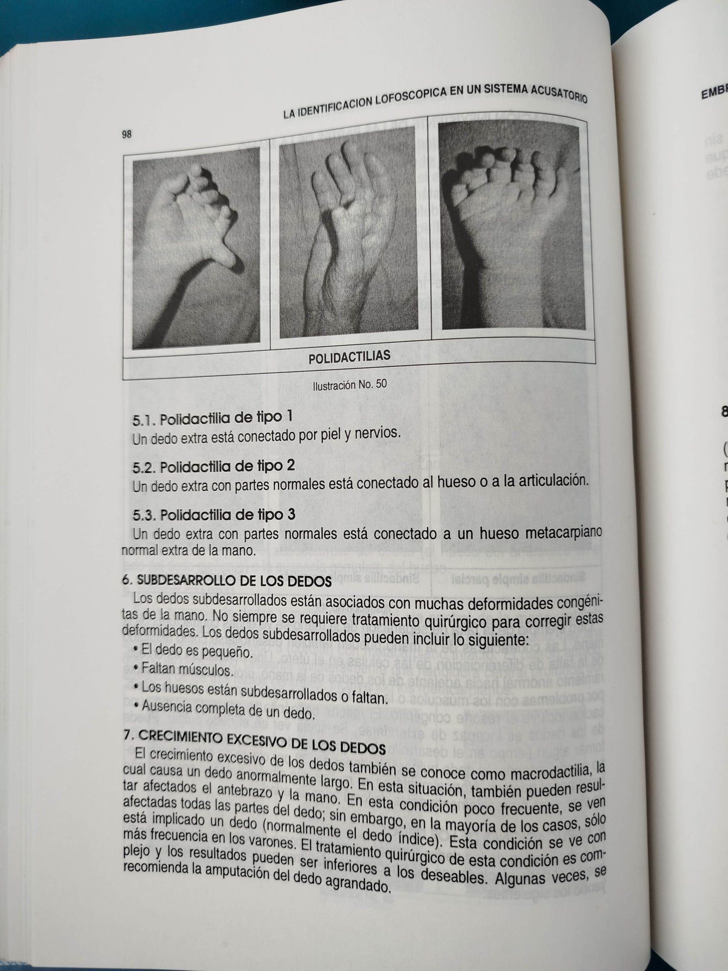 La identificación lofoscópica