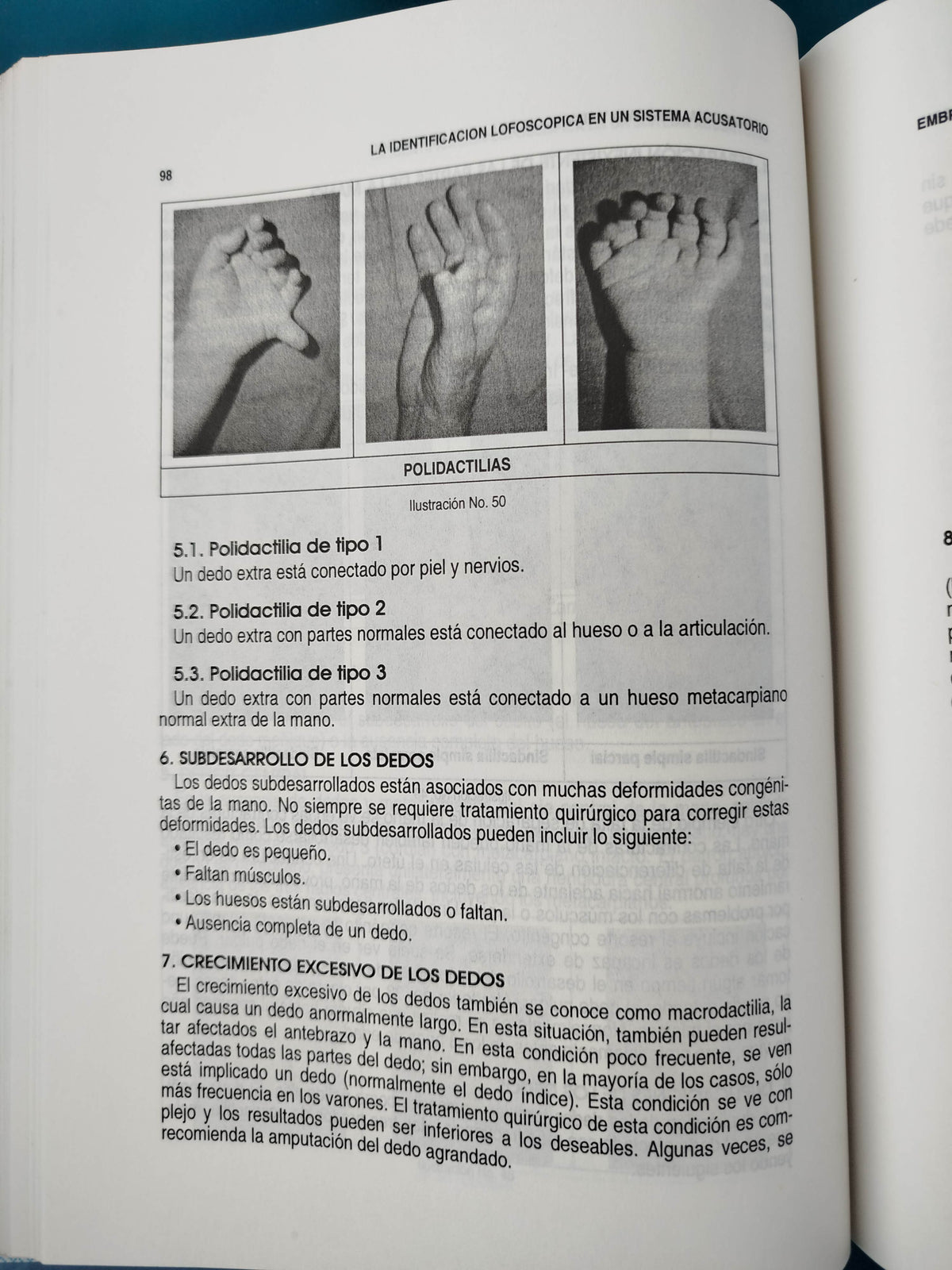 La identificación lofoscópica by Gladys Sierra Torres