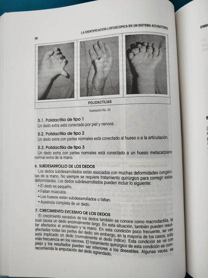 La identificación lofoscópica
