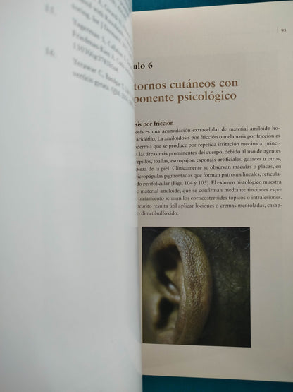 Atlas de dermatología clínica pieles oscuras