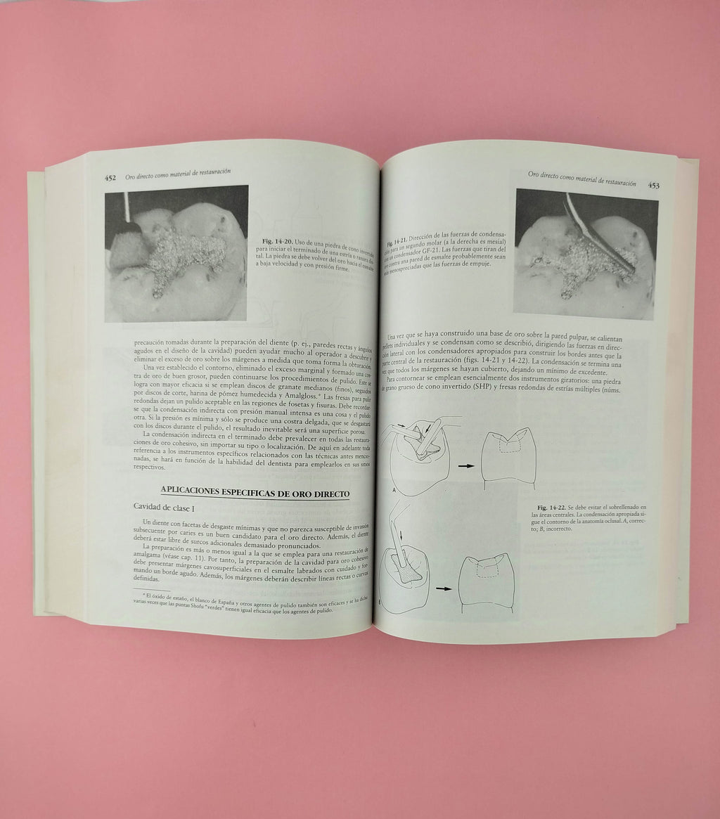 Tratado de operatoria dental Tercera edición by Baum, Phillips, Lund