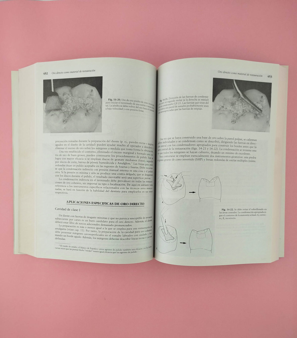 Tratado de operatoria dental Tercera edición by Baum, Phillips, Lund