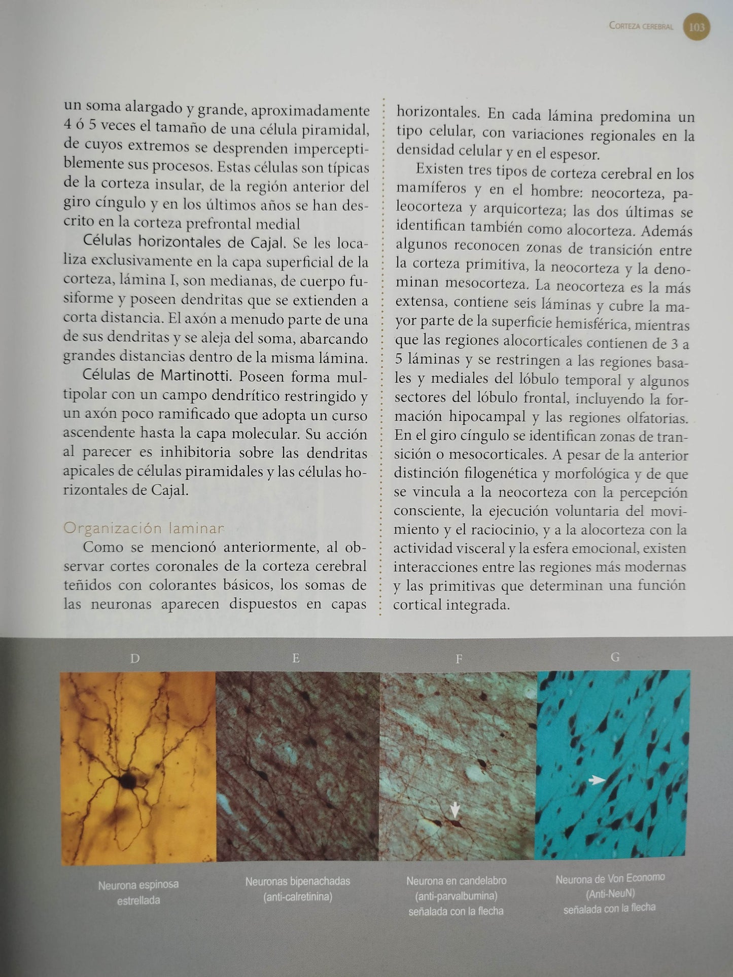 Sistema nervioso Neuroanatomía funcional y clínica by martha i escobar