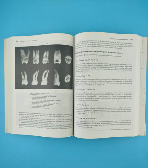 Anatomía dental, fisiología y oclusión de Wheeler Séptima edición by M M Ash