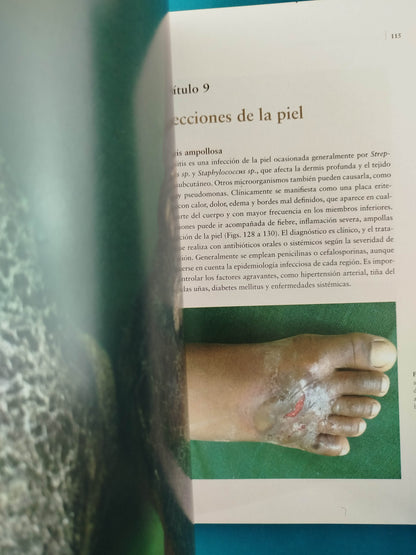 Atlas de dermatología clínica pieles oscuras