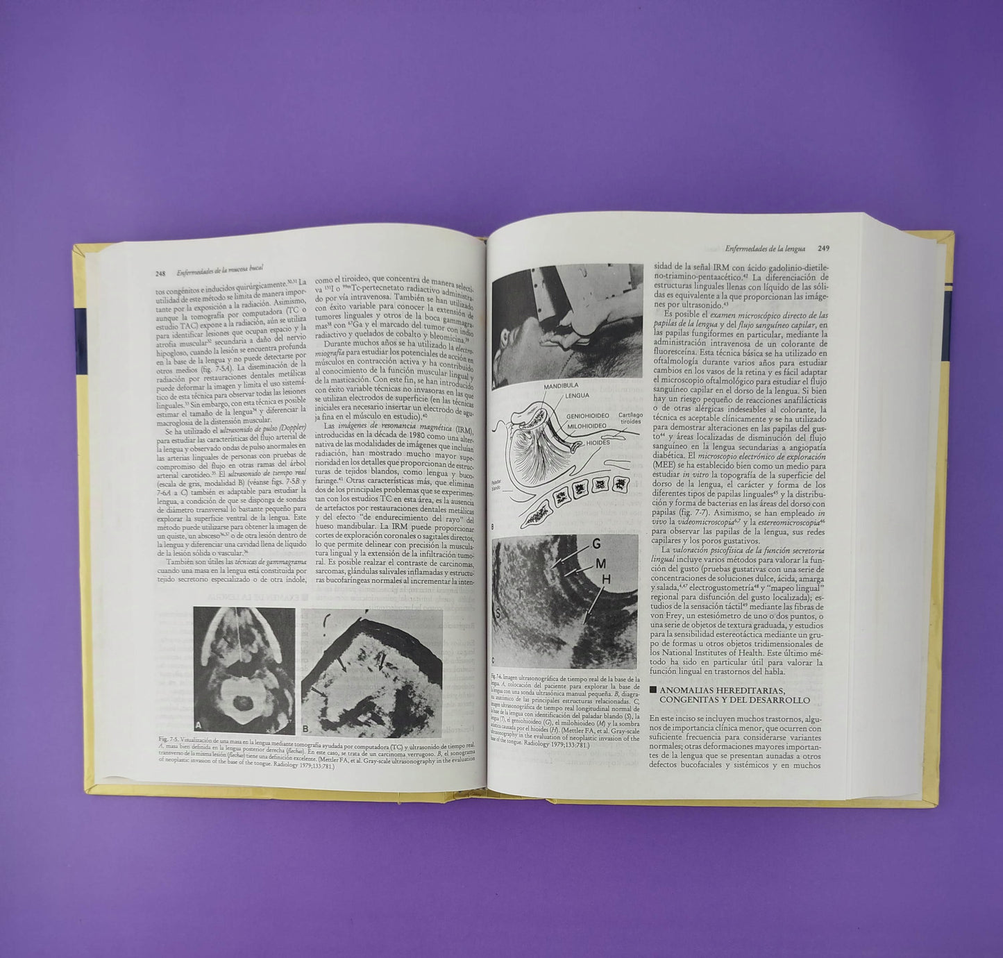 Medicina bucal de Burket novena edición