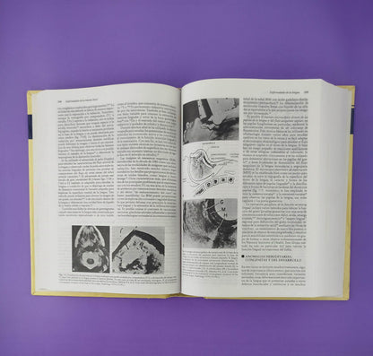 Medicina bucal de Burket novena edición