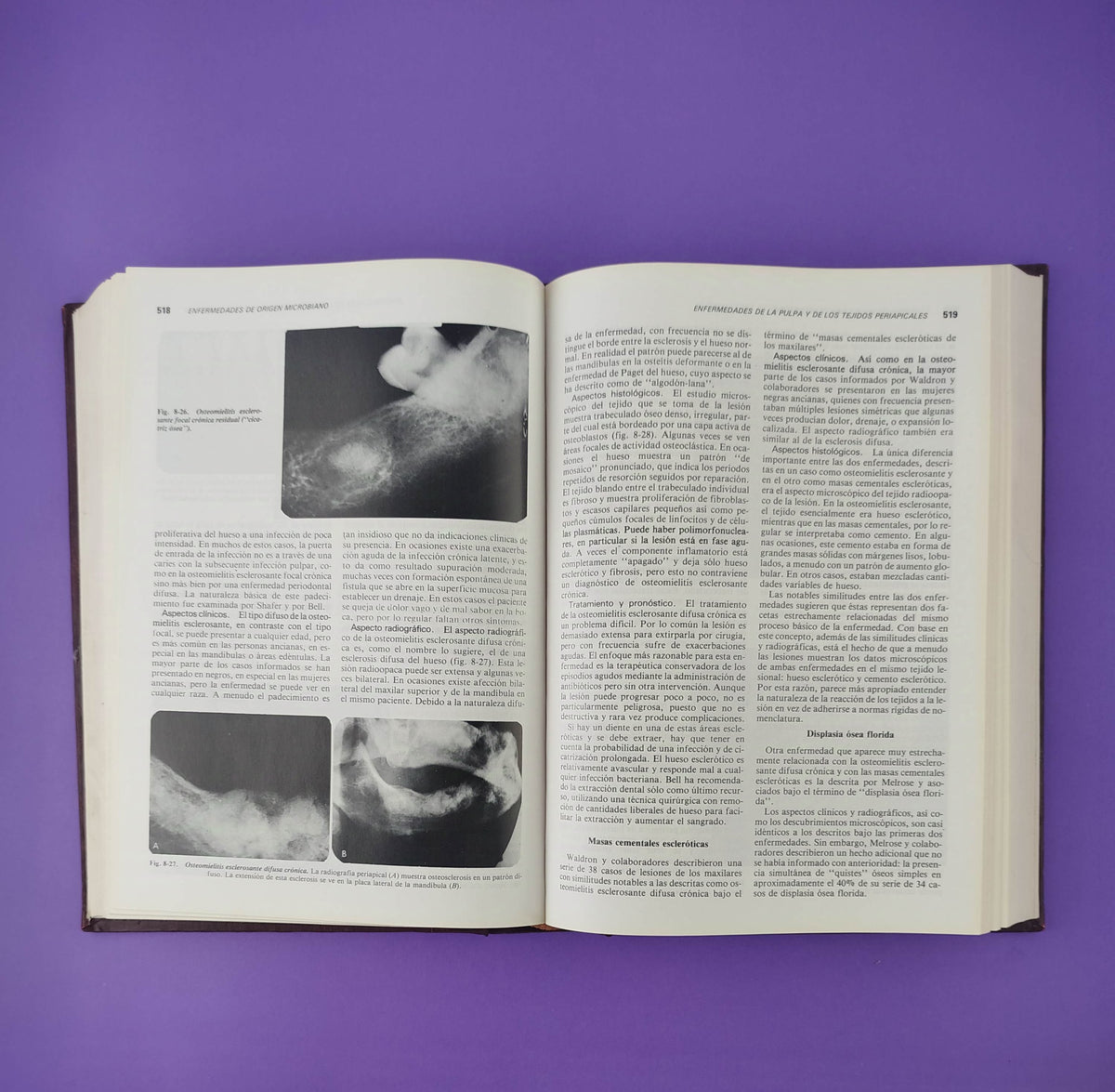 Tratado de patología bucal by W G Shaffer