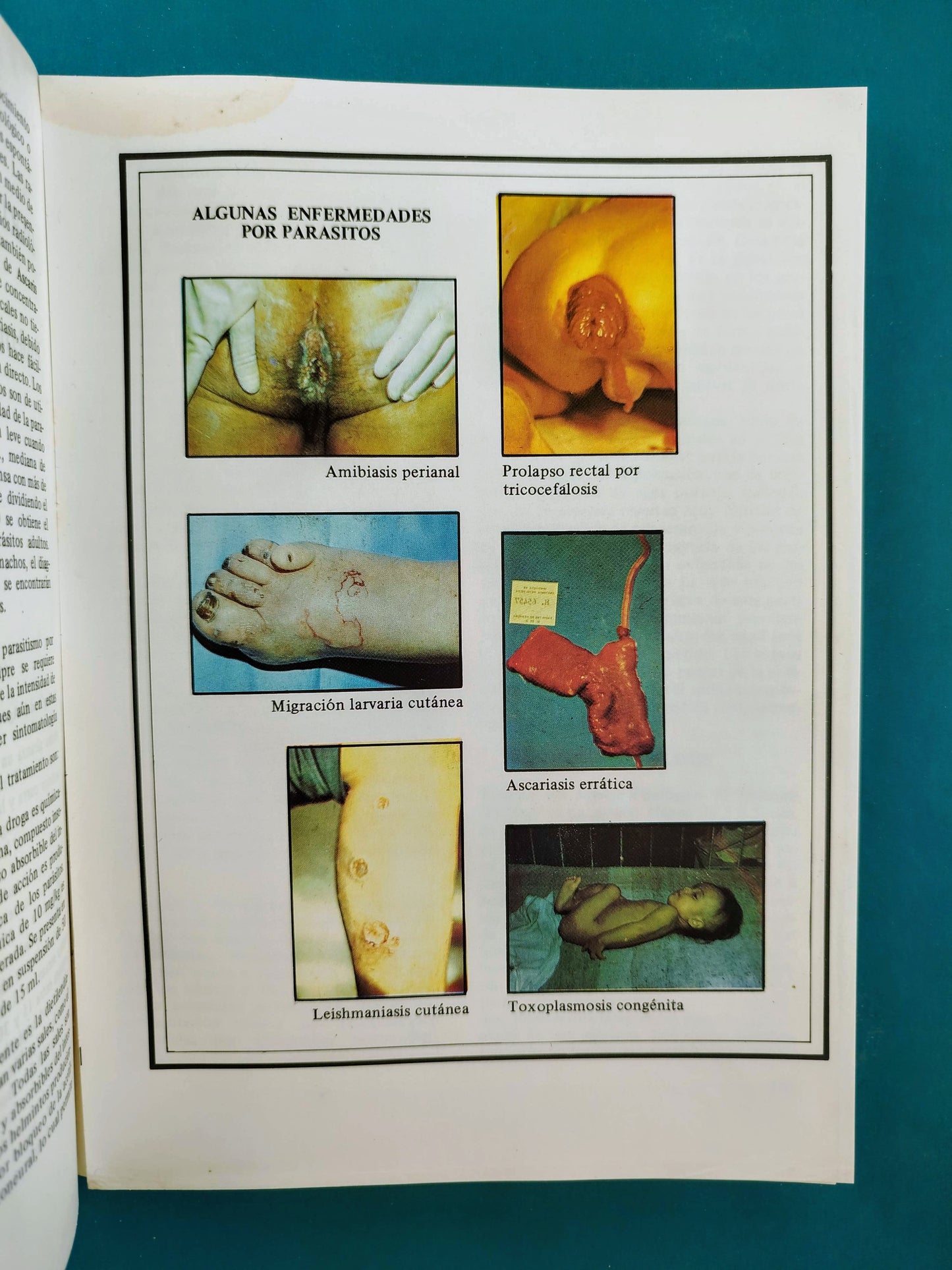 Fundamentos de medicina Enfermedades infecciosas segunda edición